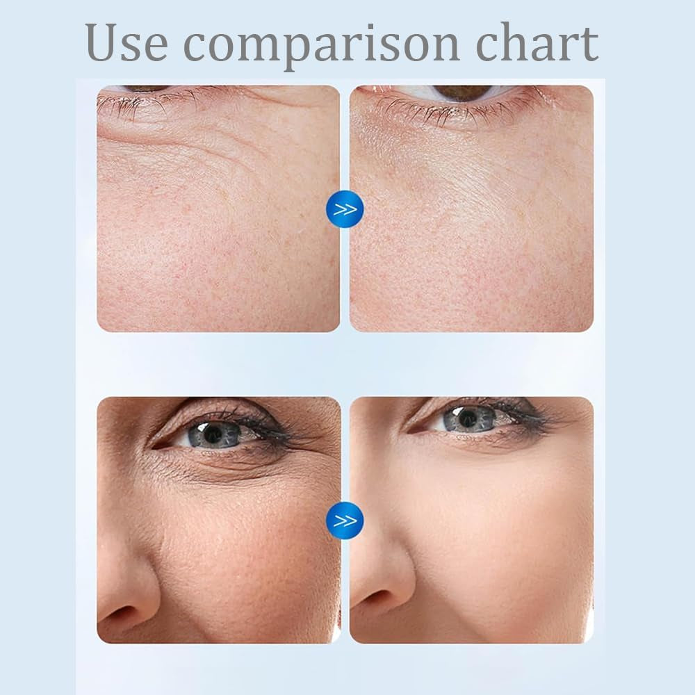 Turmskin Serum, Turmskin Hyaluronic Acid Serum, Hyaluronic Acid Tubes, 3% Hyaluronic Acid Serum Ultra-Hydrating Vials, Turmskin Serum Tubes, Ultra Hydrating Serum (3Pcs)