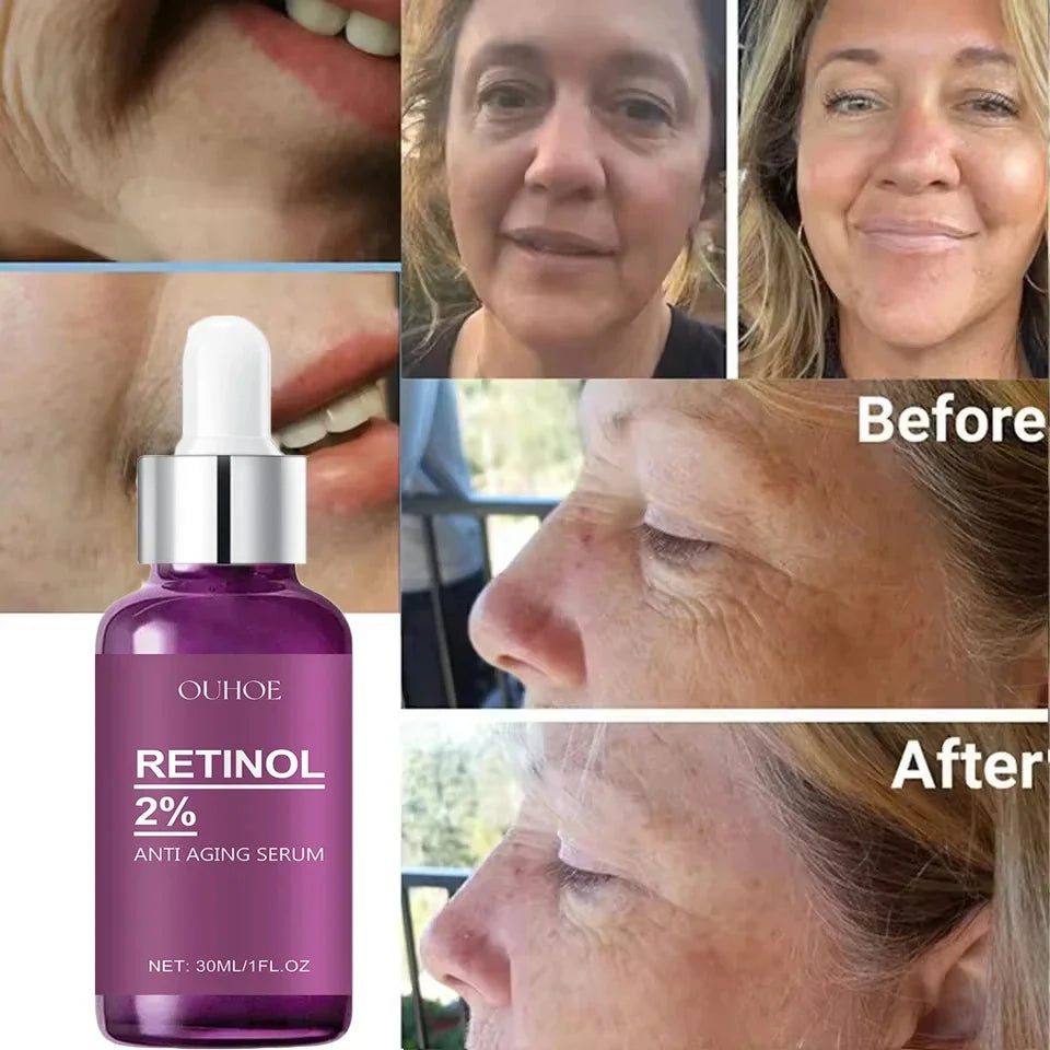 Sérum Visage Rétinol — Anti-Rides & Lissant Puissant