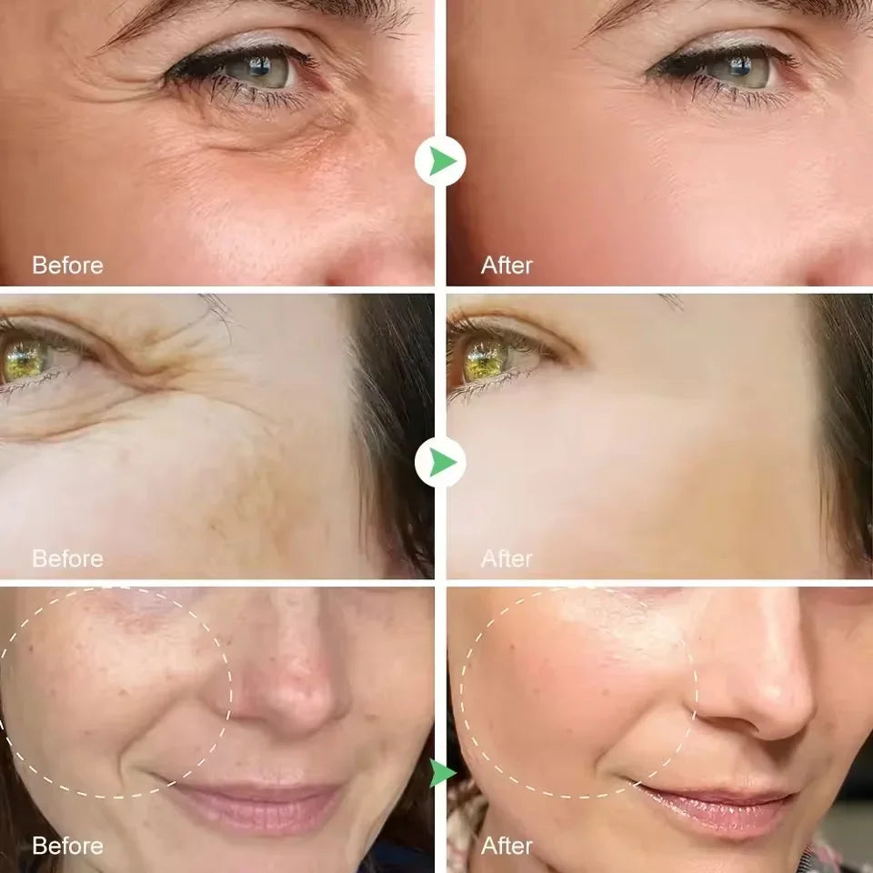 Sérum Visage Rétinol — Anti-Rides & Lissant Puissant
